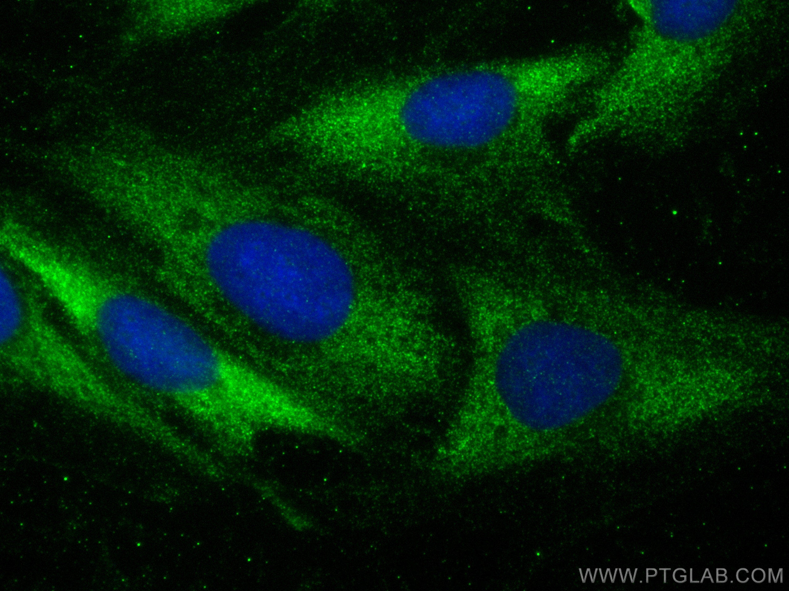 Immunofluorescence (IF) / fluorescent staining of H9C2 cells using MYH7-specific Polyclonal antibody (22280-1-AP)