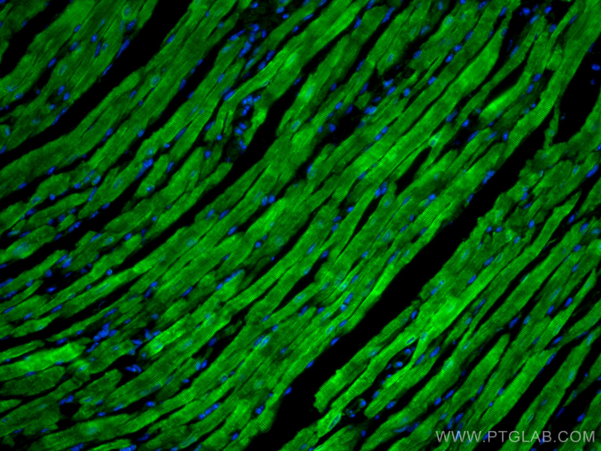 Immunofluorescence (IF) / fluorescent staining of mouse heart tissue using MYH7-specific Polyclonal antibody (22280-1-AP)