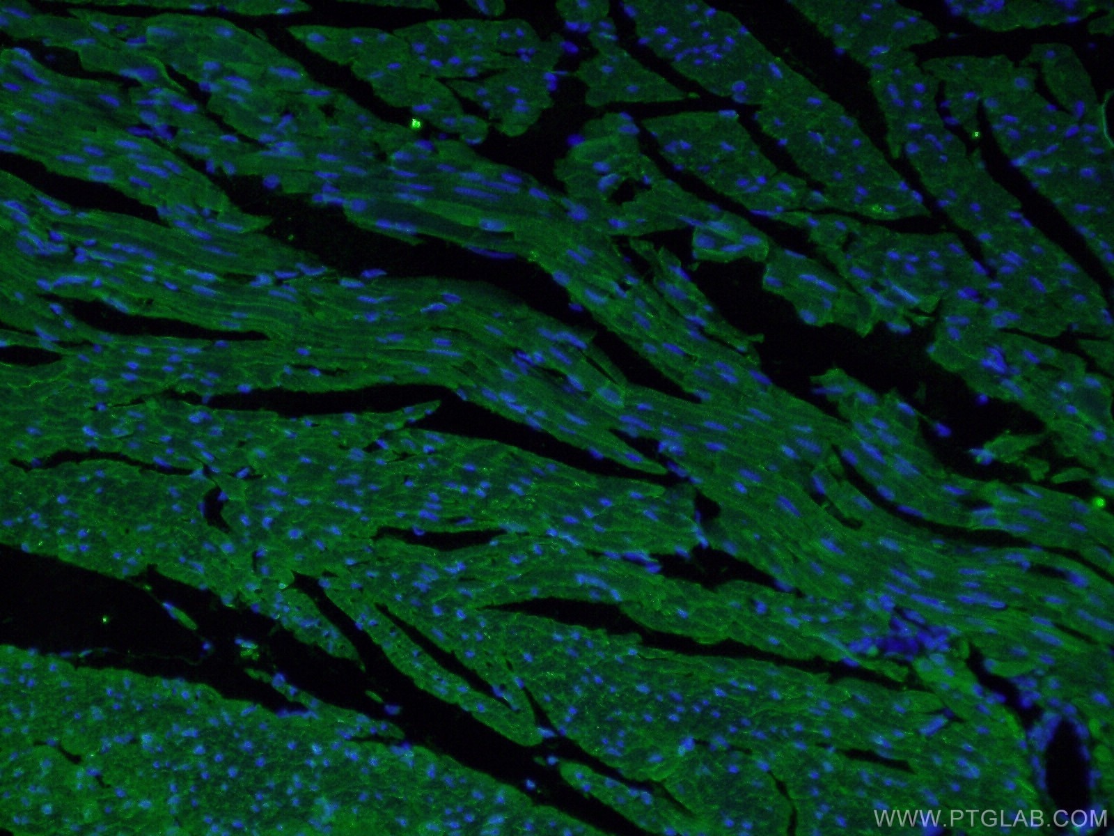 Immunofluorescence (IF) / fluorescent staining of mouse heart tissue using MYH7-specific Polyclonal antibody (22280-1-AP)