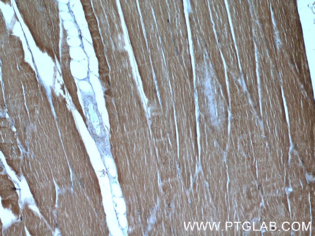 IHC staining of human skeletal muscle using 22280-1-AP