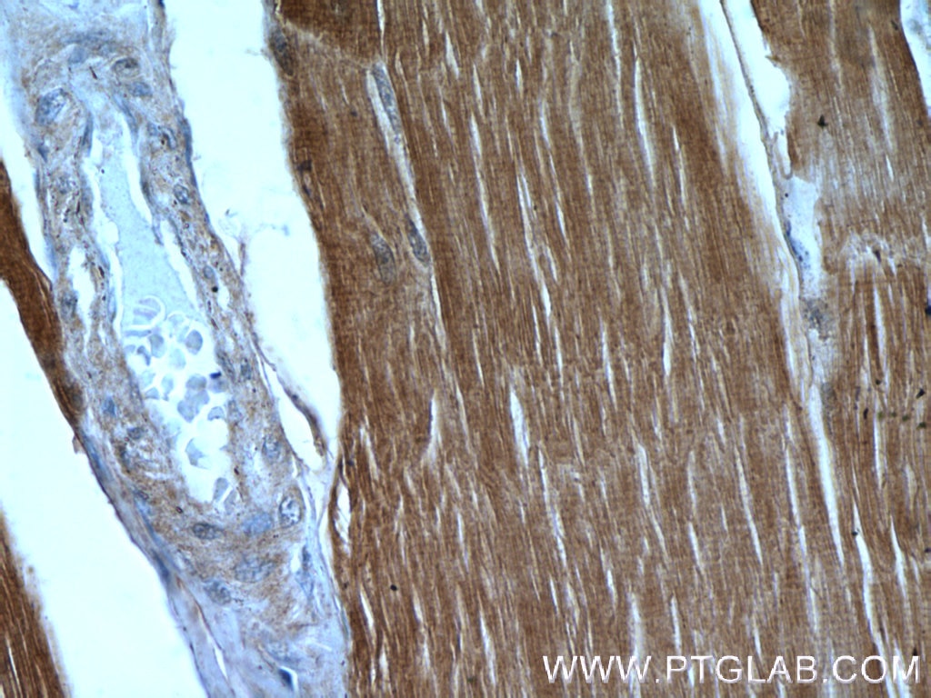 Immunohistochemistry (IHC) staining of human skeletal muscle tissue using MYH7-specific Polyclonal antibody (22280-1-AP)
