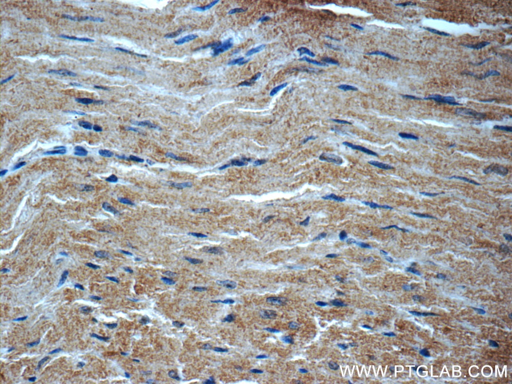 Immunohistochemistry (IHC) staining of mouse heart tissue using MYH7-specific Polyclonal antibody (22280-1-AP)