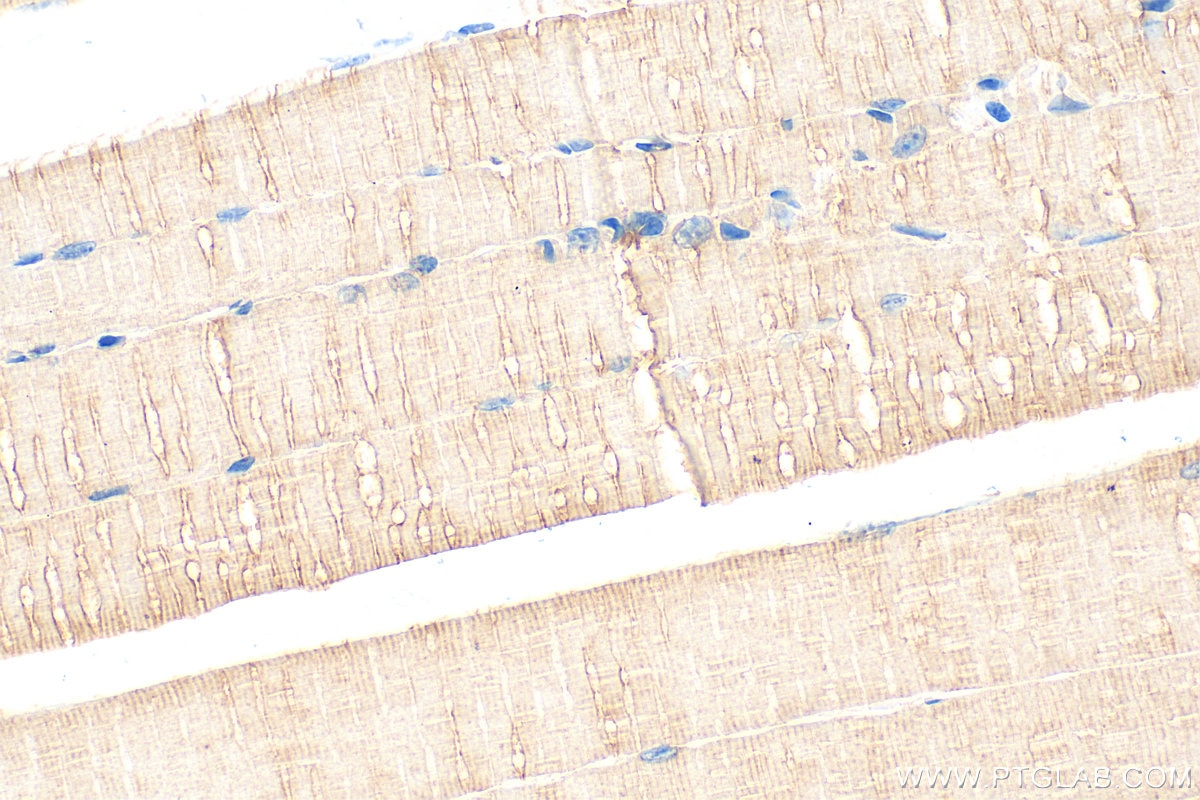 Immunohistochemistry (IHC) staining of mouse skeletal muscle tissue using MYH7-specific Polyclonal antibody (22280-1-AP)