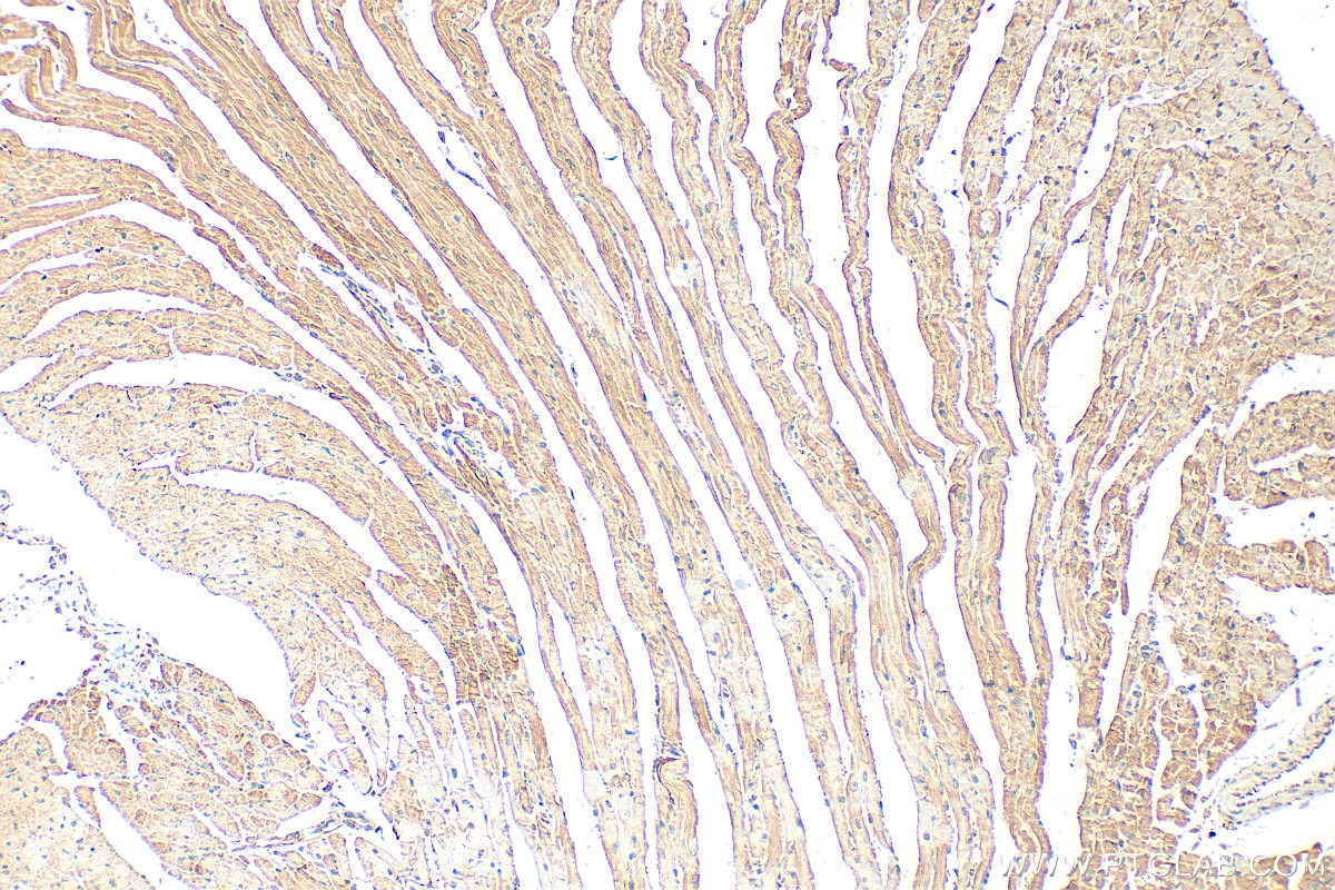 Immunohistochemistry (IHC) staining of mouse heart tissue using MYH7-specific Polyclonal antibody (22280-1-AP)