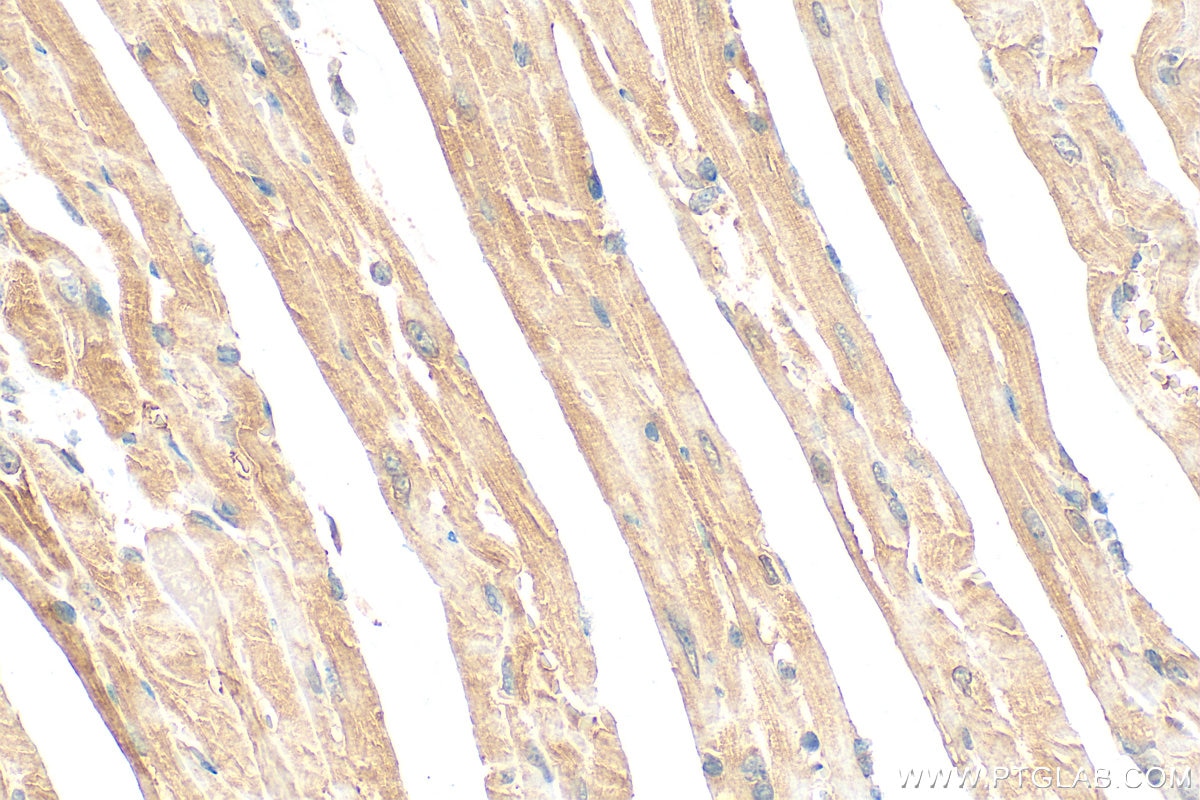 Immunohistochemistry (IHC) staining of mouse heart tissue using MYH7-specific Polyclonal antibody (22280-1-AP)