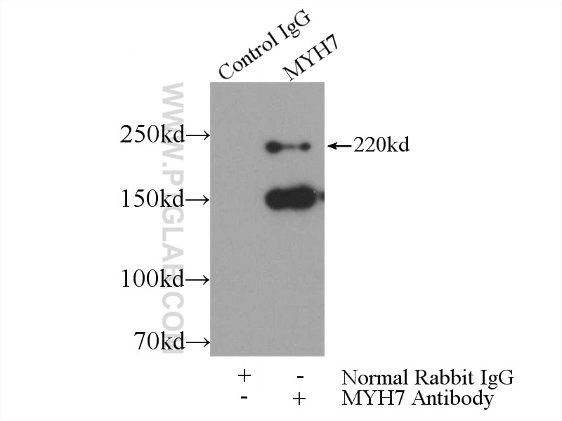 Immunoprecipitation (IP) experiment of mouse heart tissue using MYH7-specific Polyclonal antibody (22280-1-AP)