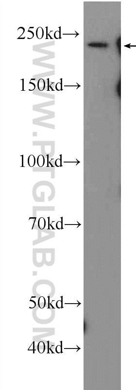 Western Blot (WB) analysis of mouse heart tissue using MYH7-specific Polyclonal antibody (22280-1-AP)