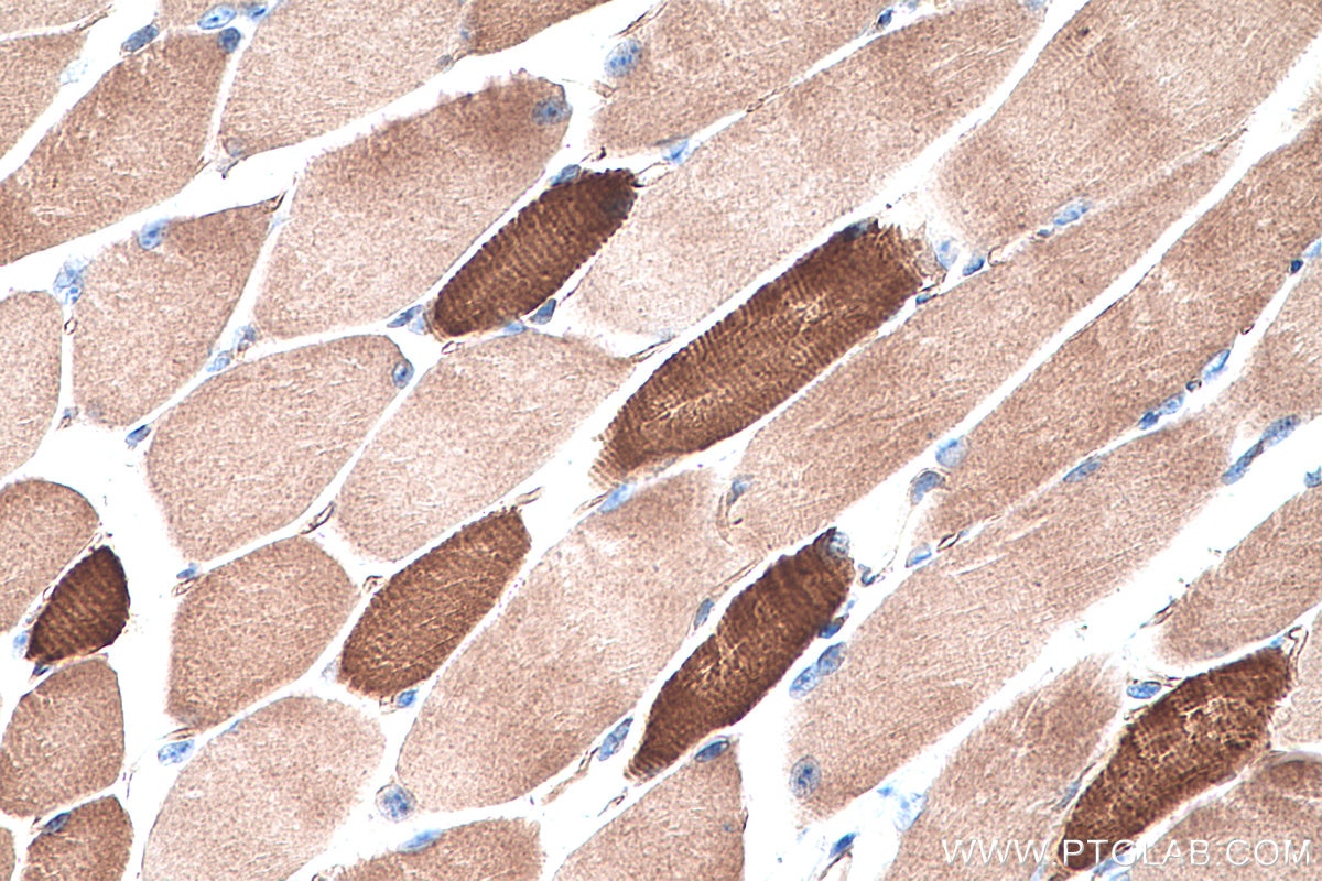 Immunohistochemistry (IHC) staining of mouse skeletal muscle tissue using MYH8-Specific Polyclonal antibody (18988-1-AP)