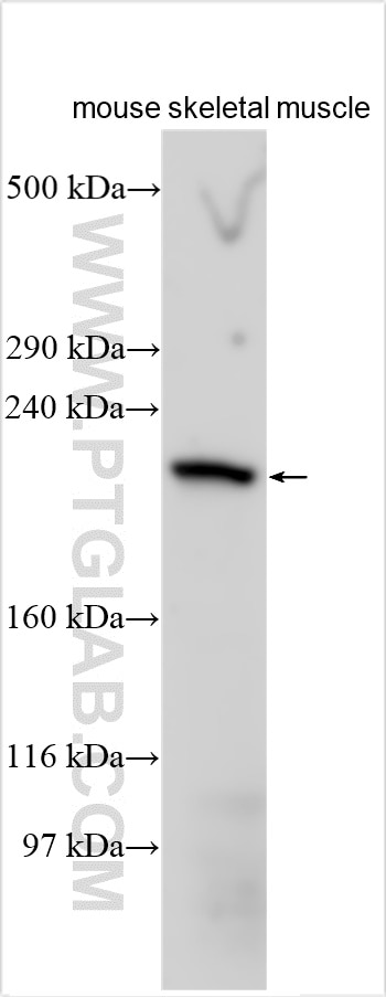 Western Blot (WB) analysis of various lysates using MYH8-Specific Polyclonal antibody (18988-1-AP)