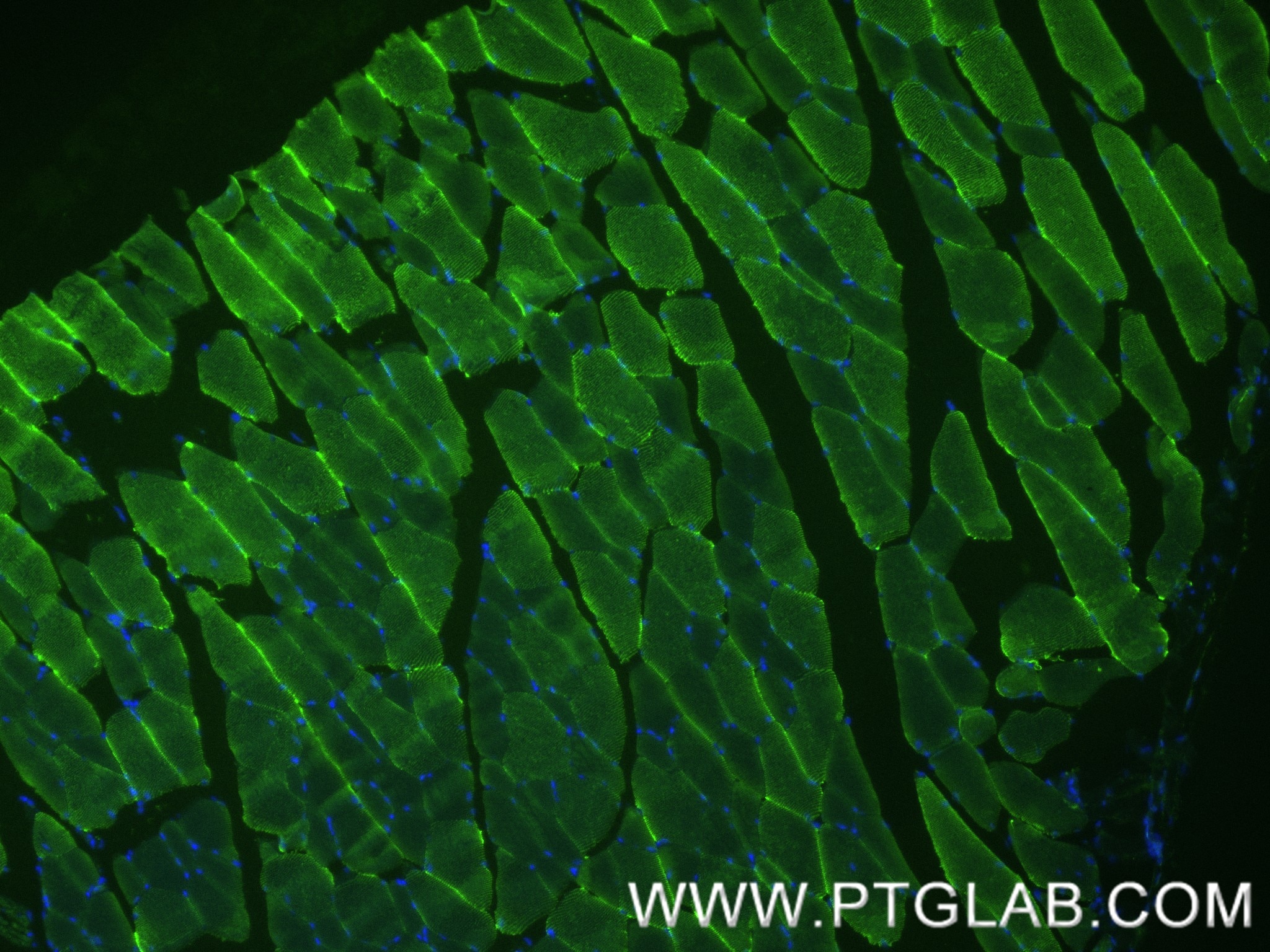 Immunofluorescence (IF) / fluorescent staining of mouse skeletal muscle tissue using MYH8-Specific Recombinant antibody (84594-1-RR)