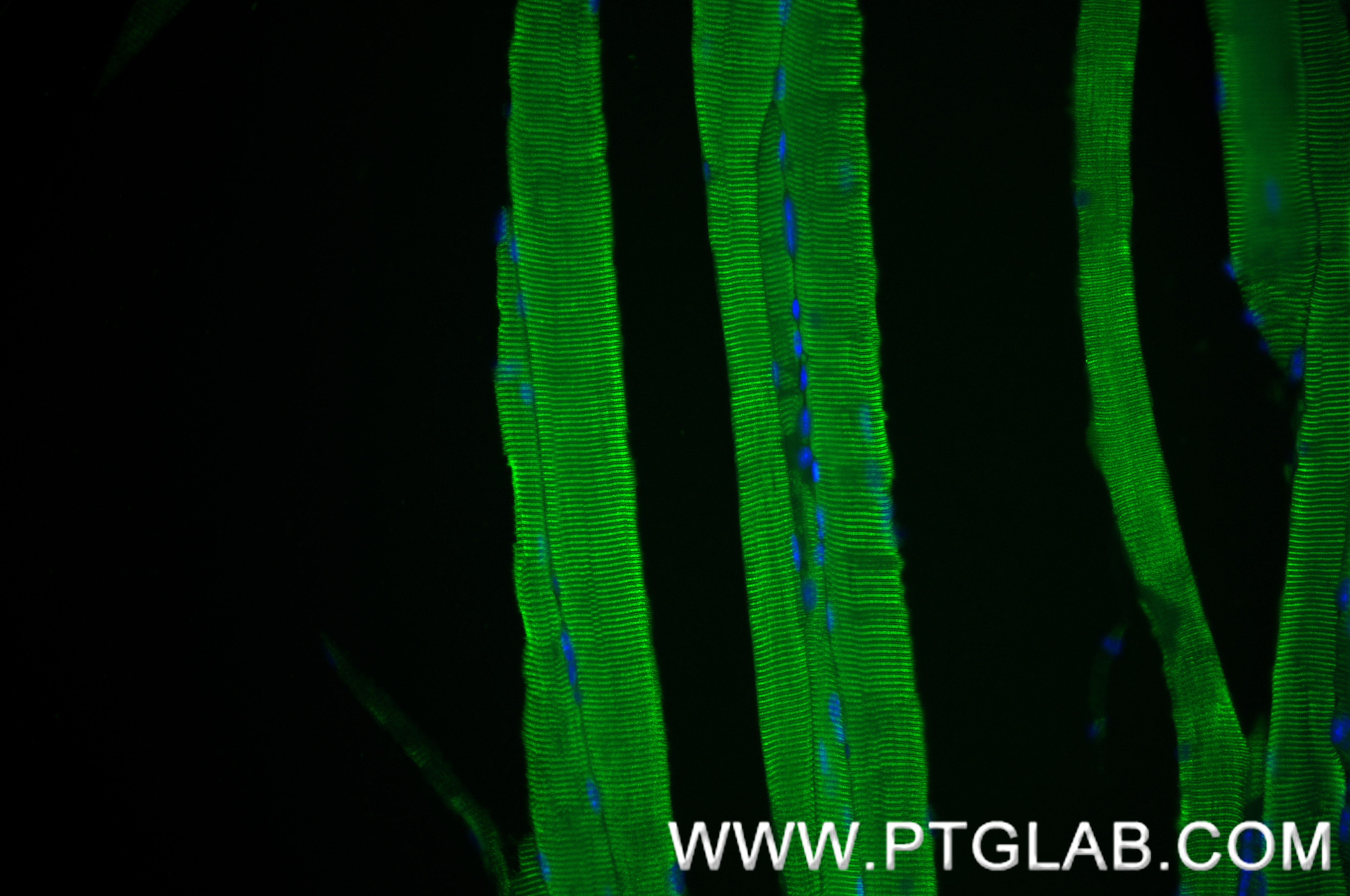 Immunofluorescence (IF) / fluorescent staining of mouse skeletal muscle tissue using MYH8-Specific Recombinant antibody (84594-1-RR)