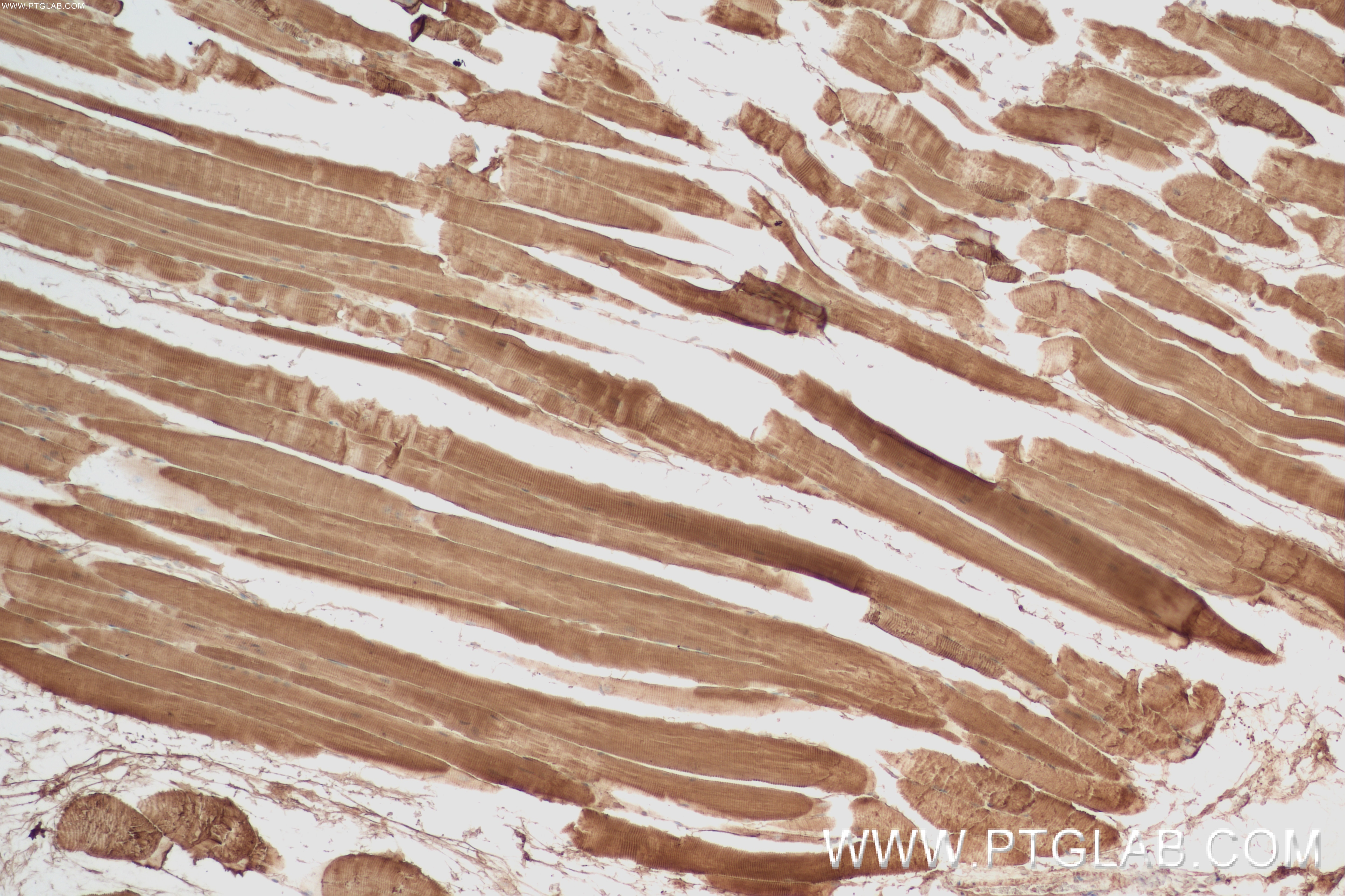 Immunohistochemistry (IHC) staining of mouse skeletal muscle tissue using MYH8-Specific Recombinant antibody (84594-1-RR)
