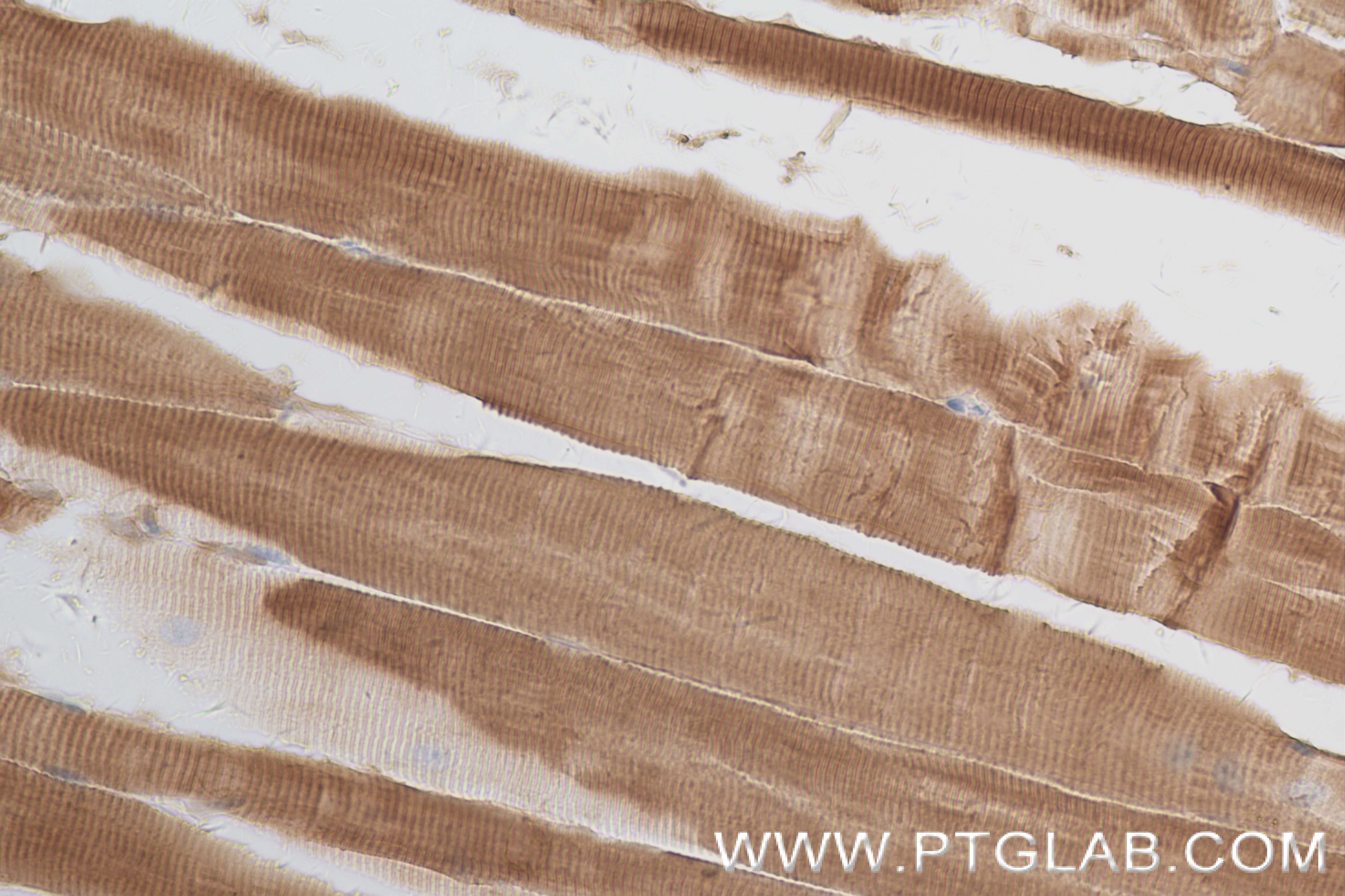 Immunohistochemistry (IHC) staining of mouse skeletal muscle tissue using MYH8-Specific Recombinant antibody (84594-1-RR)