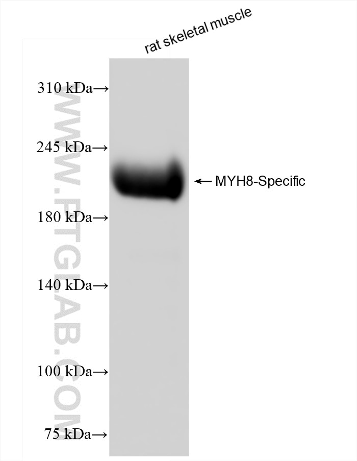 Western Blot (WB) analysis of rat skeletal muscle tissue using MYH8-Specific Recombinant antibody (84594-1-RR)