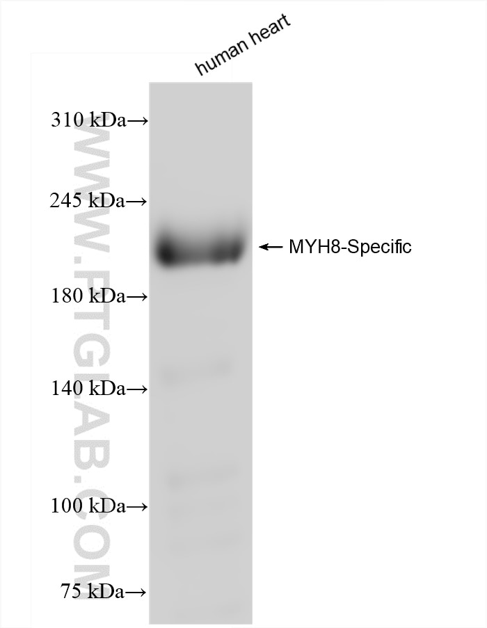 Western Blot (WB) analysis of human heart tissue using MYH8-Specific Recombinant antibody (84594-1-RR)