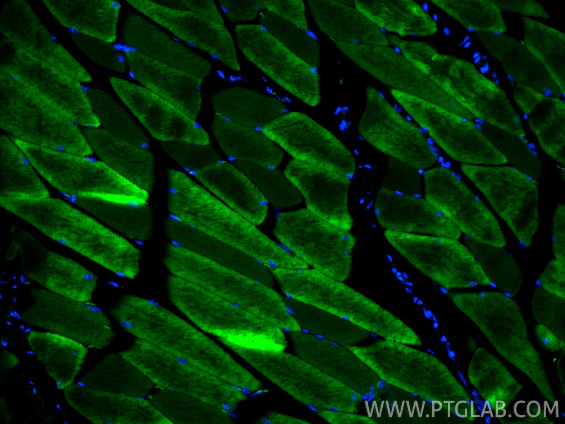 Immunofluorescence (IF) / fluorescent staining of mouse skeletal muscle tissue using CoraLite® Plus 488-conjugated MYH8-Specific Recomb (CL488-84594)