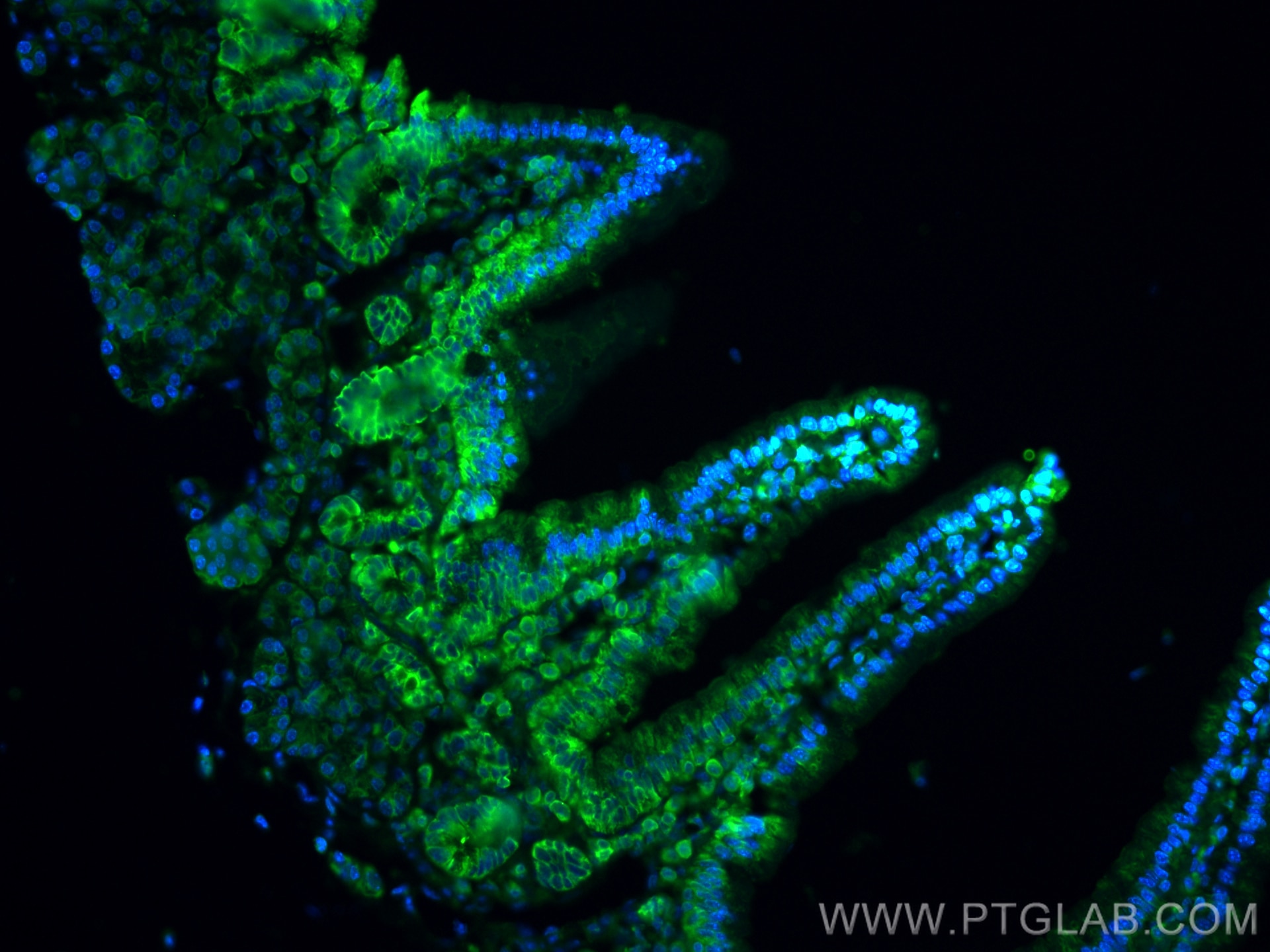 Immunofluorescence (IF) / fluorescent staining of mouse small intestine tissue using MYH9 Polyclonal antibody (11128-1-AP)