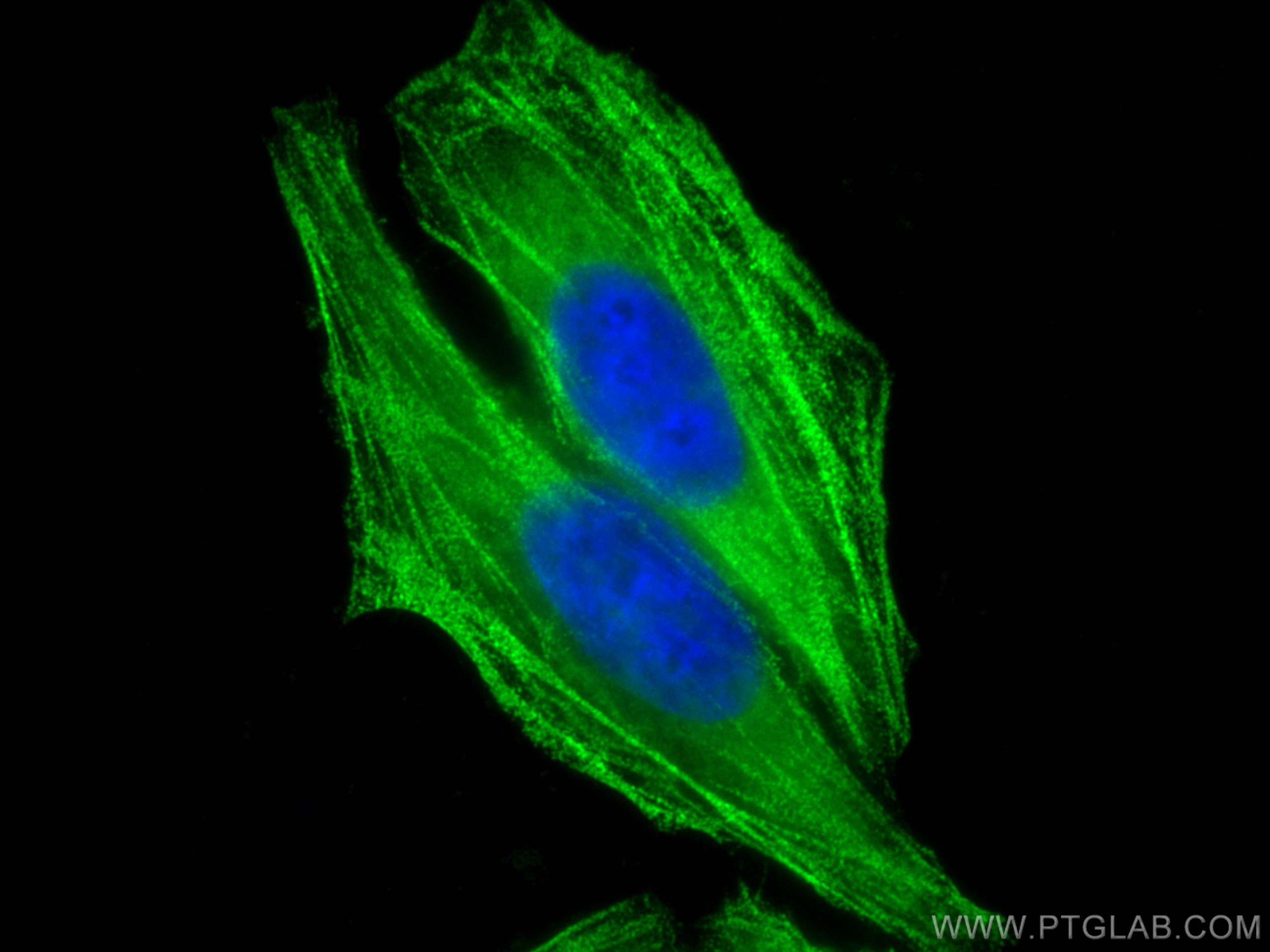 Immunofluorescence (IF) / fluorescent staining of HepG2 cells using MYH9 Polyclonal antibody (11128-1-AP)