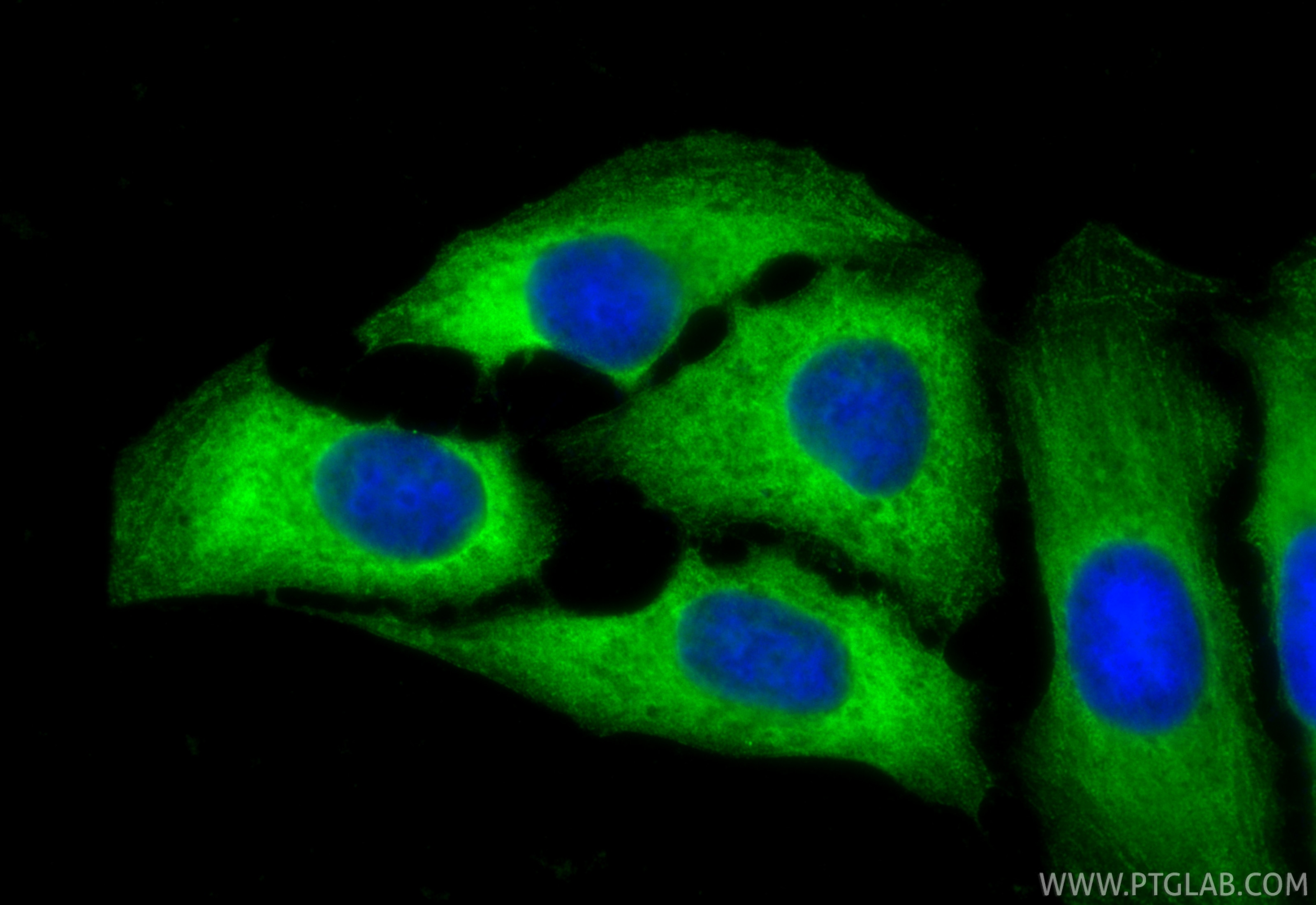 Immunofluorescence (IF) / fluorescent staining of U2OS cells using MYH9 Polyclonal antibody (11128-1-AP)