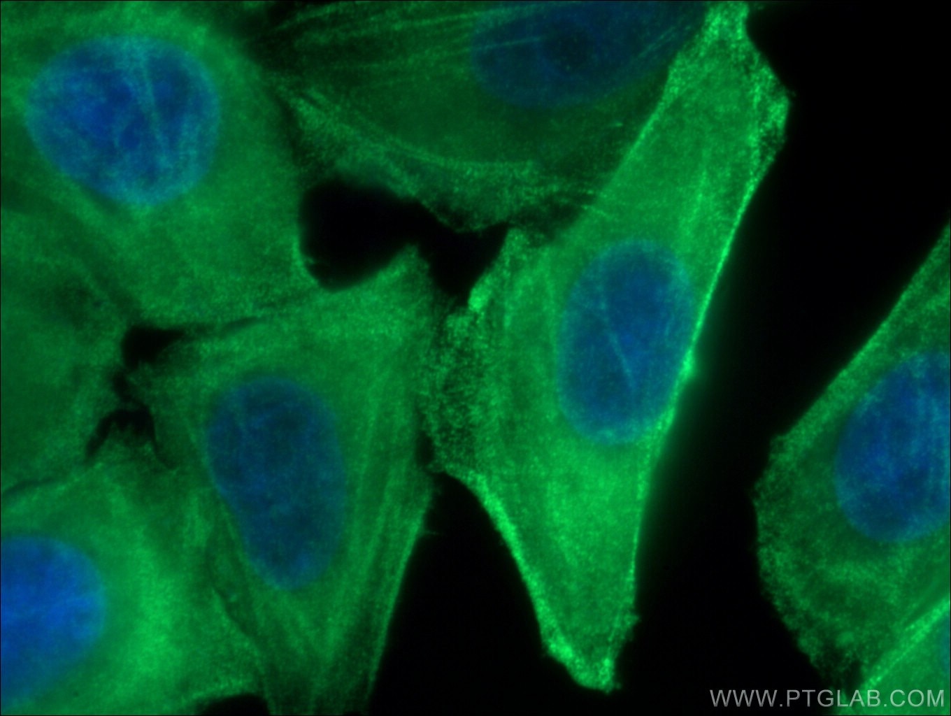 MYH9 Polyclonal antibody