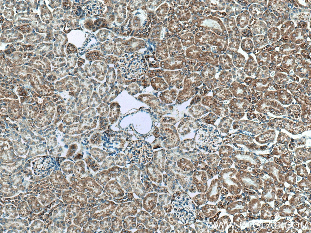 Immunohistochemistry (IHC) staining of mouse kidney tissue using MYH9 Polyclonal antibody (11128-1-AP)