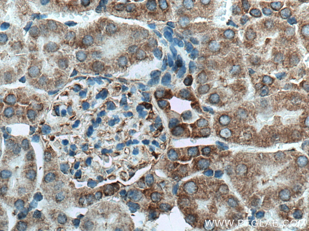 IHC staining of mouse kidney using 11128-1-AP