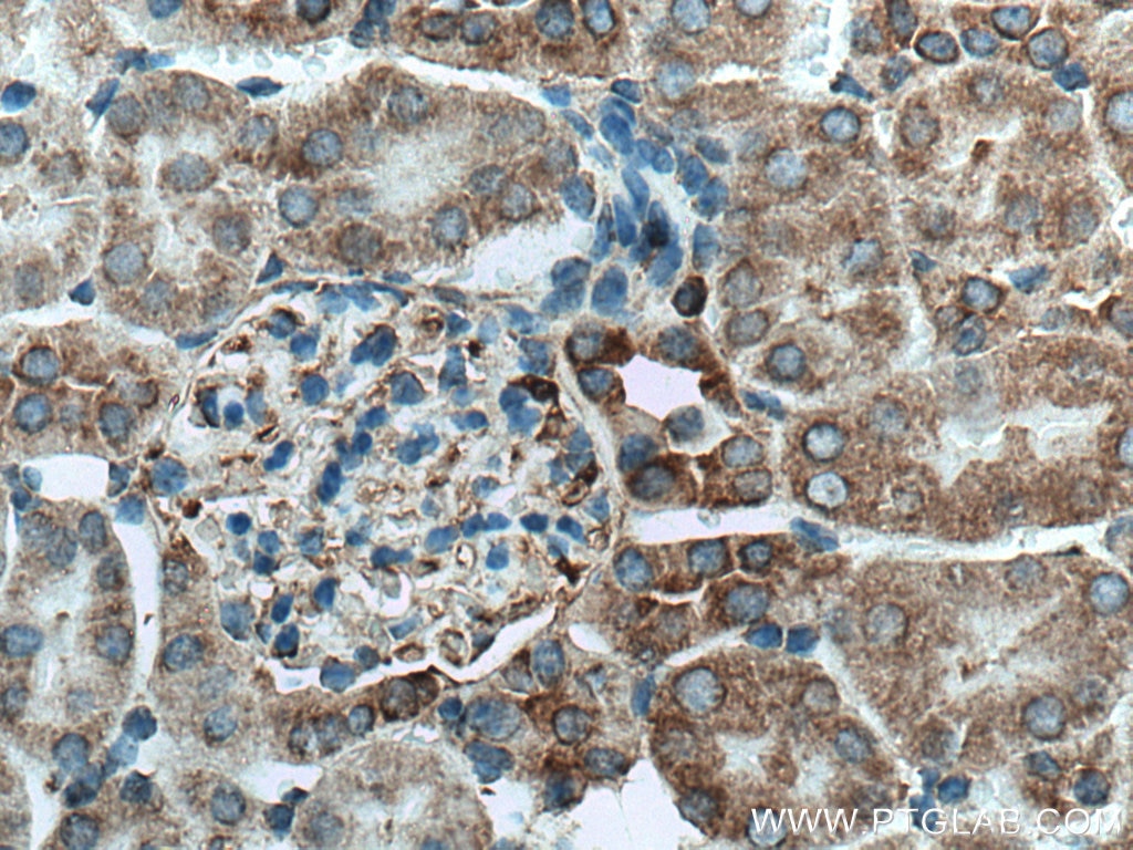 Immunohistochemistry (IHC) staining of mouse kidney tissue using MYH9 Polyclonal antibody (11128-1-AP)