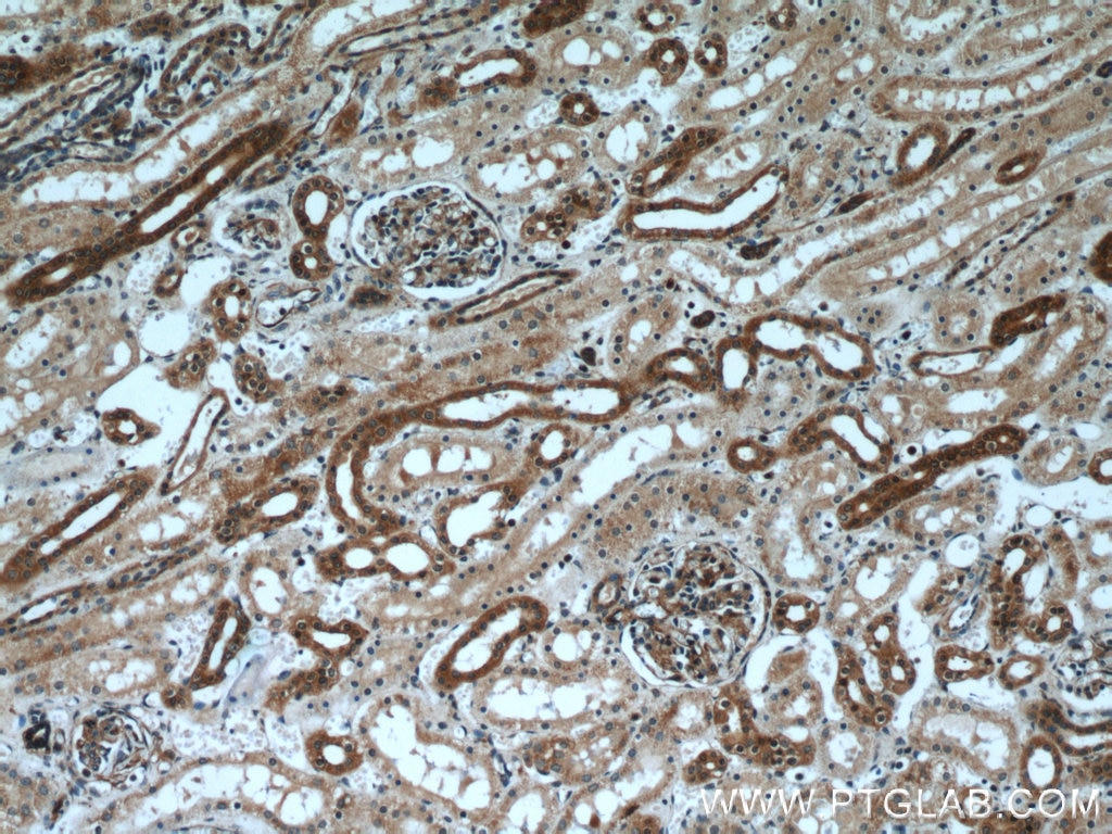 Immunohistochemistry (IHC) staining of human kidney tissue using MYH9 Polyclonal antibody (11128-1-AP)