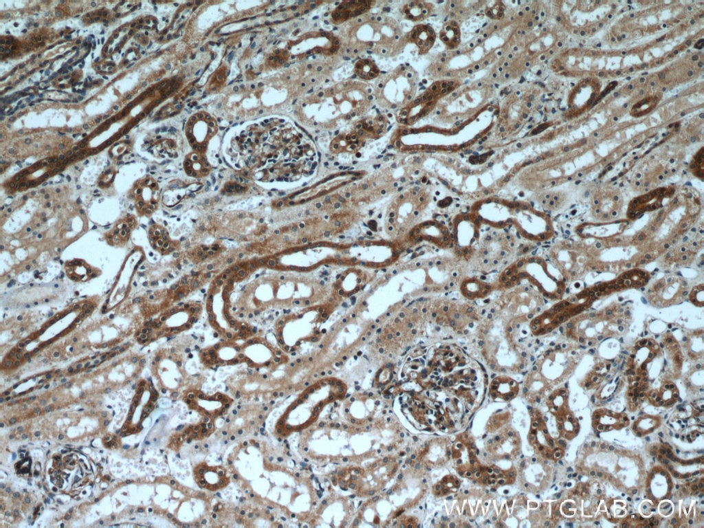 IHC staining of human kidney using 11128-1-AP