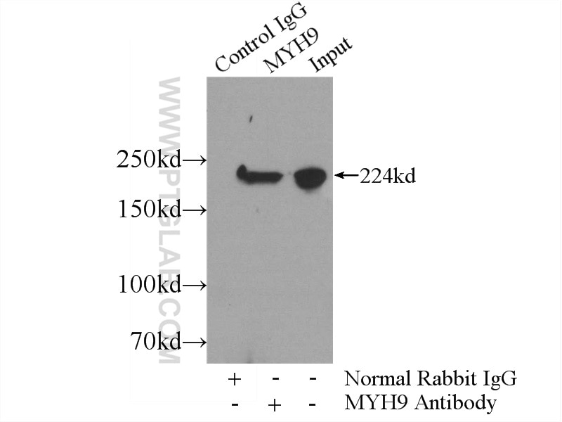 Immunoprecipitation (IP) experiment of mouse brain tissue using MYH9 Polyclonal antibody (11128-1-AP)