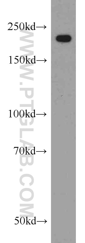 Western Blot (WB) analysis of mouse brain tissue using MYH9 Polyclonal antibody (11128-1-AP)