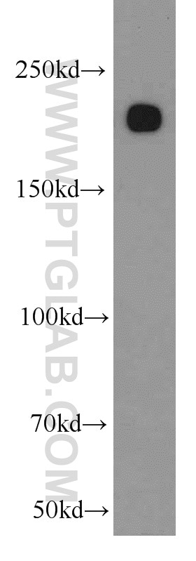 Western Blot (WB) analysis of mouse kidney tissue using MYH9 Polyclonal antibody (11128-1-AP)