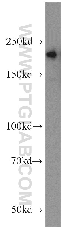 WB analysis of mouse colon using 11128-1-AP