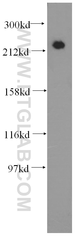 Western Blot (WB) analysis of human brain tissue using MYH9 Polyclonal antibody (11128-1-AP)