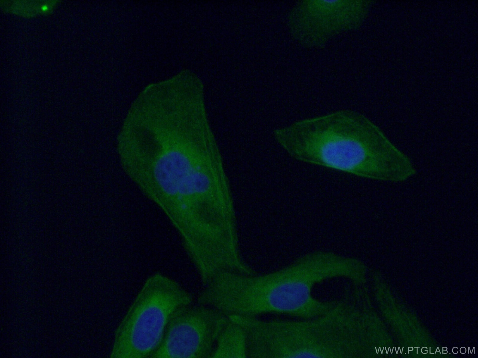 Immunofluorescence (IF) / fluorescent staining of U2OS cells using MYH9 Monoclonal antibody (60233-1-Ig)