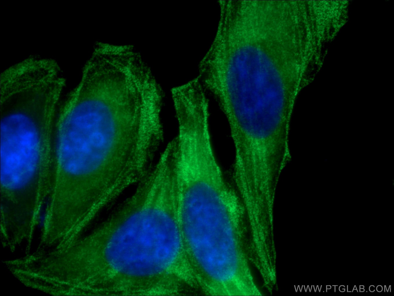 Immunofluorescence (IF) / fluorescent staining of HepG2 cells using MYH9 Monoclonal antibody (60233-1-Ig)