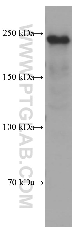 Western Blot (WB) analysis of human kidney tissue using MYH9 Monoclonal antibody (60233-1-Ig)