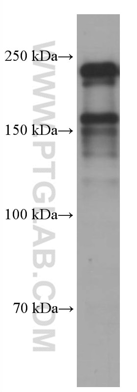 Western Blot (WB) analysis of pig spleen tissue using MYH9 Monoclonal antibody (60233-1-Ig)