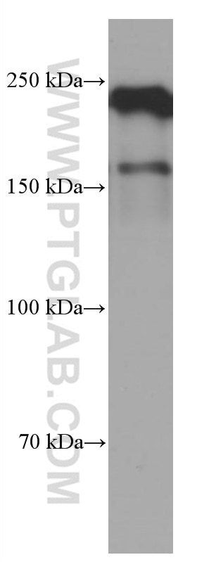 Western Blot (WB) analysis of pig pancreas tissue using MYH9 Monoclonal antibody (60233-1-Ig)