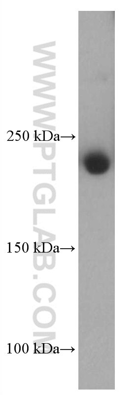 Western Blot (WB) analysis of A431 cells using MYH9 Monoclonal antibody (60233-1-Ig)