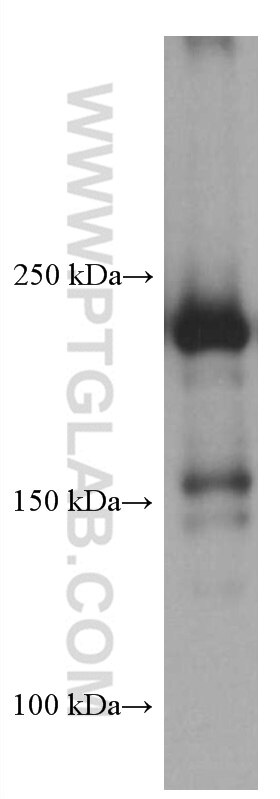 Western Blot (WB) analysis of human placenta tissue using MYH9 Monoclonal antibody (60233-1-Ig)