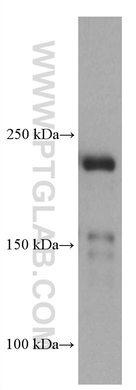 Western Blot (WB) analysis of pig kidney tissue using MYH9 Monoclonal antibody (60233-1-Ig)