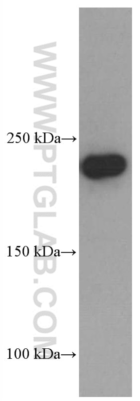 Western Blot (WB) analysis of mouse kidney tissue using MYH9 Monoclonal antibody (60233-1-Ig)