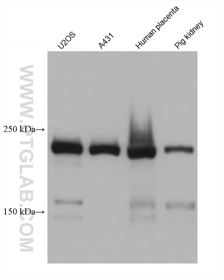 Western Blot (WB) analysis of various lysates using MYH9 Monoclonal antibody (60233-1-Ig)
