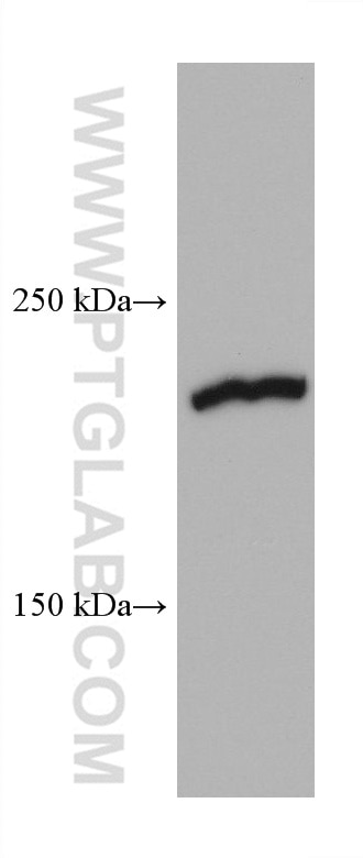 Western Blot (WB) analysis of mouse colon tissue using MYH9 Monoclonal antibody (60233-1-Ig)