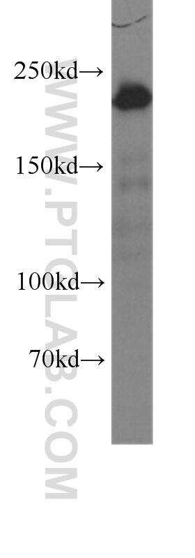 MYH9 Monoclonal antibody