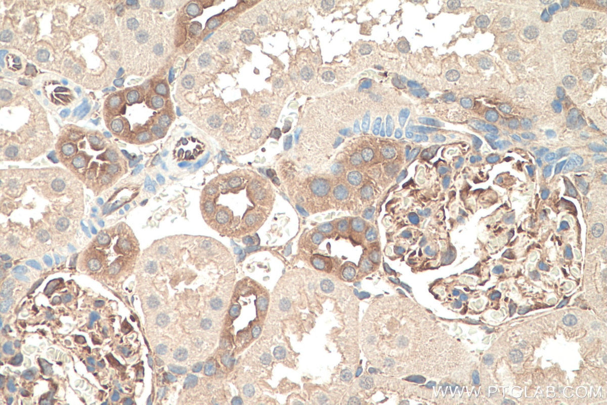 Immunohistochemistry (IHC) staining of rat kidney tissue using MYH9 Recombinant antibody (81204-1-RR)