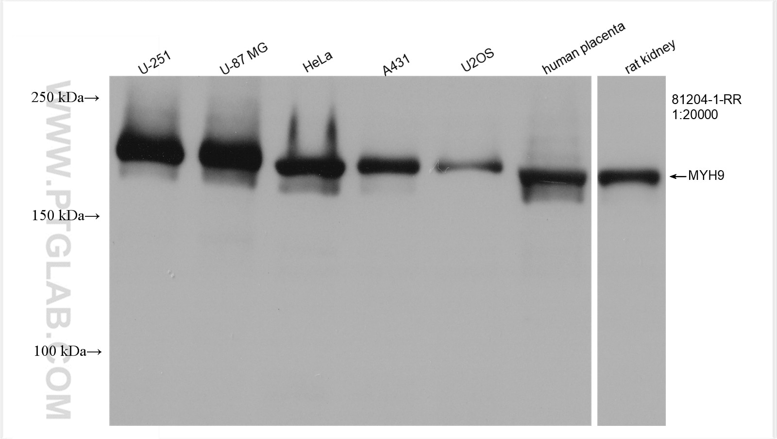 Western Blot (WB) analysis of various lysates using MYH9 Recombinant antibody (81204-1-RR)
