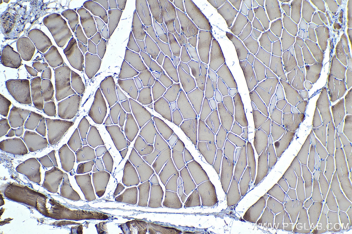 Immunohistochemistry (IHC) staining of rat skeletal muscle tissue using MYL1 Polyclonal antibody (15814-1-AP)