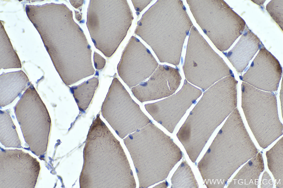 Immunohistochemistry (IHC) staining of rat skeletal muscle tissue using MYL1 Polyclonal antibody (15814-1-AP)